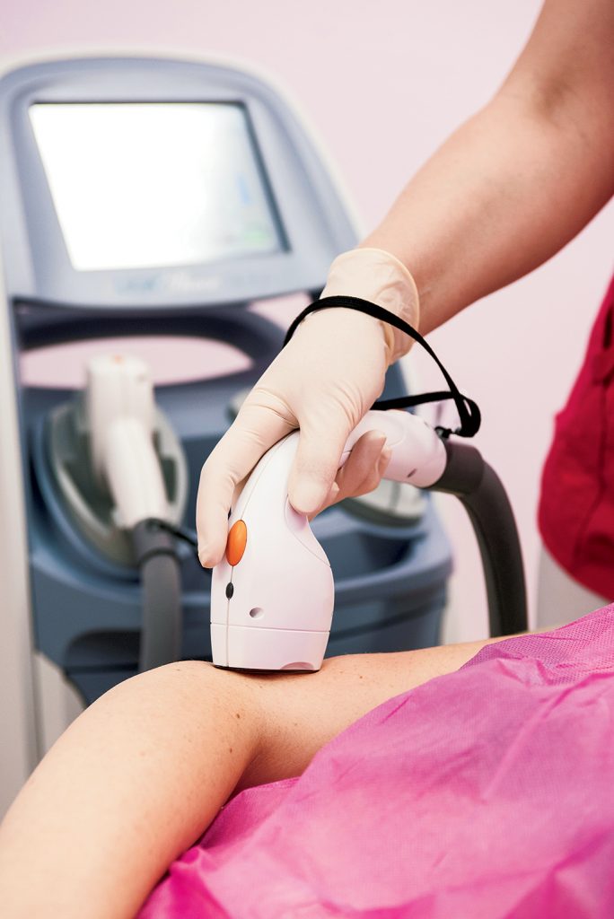 Is Laser Hair Removal Right for You? - Washingtonian